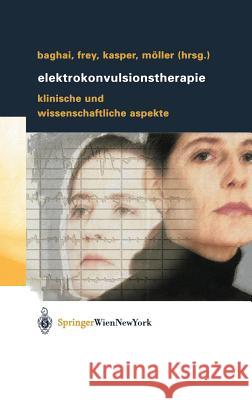 Elektrokonvulsionstherapie: Klinische Und Wissenschaftliche Aspekte Baghai, Thomas 9783211838792 Springer