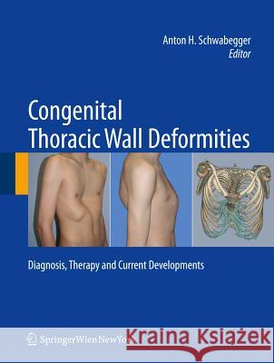 Congenital Thoracic Wall Deformities: Diagnosis, Therapy and Current Developments Schwabegger, Anton H. 9783211991374 Springer