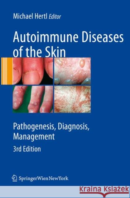 Autoimmune Diseases of the Skin: Pathogenesis, Diagnosis, Management Hertl, Michael 9783211992241 Springer