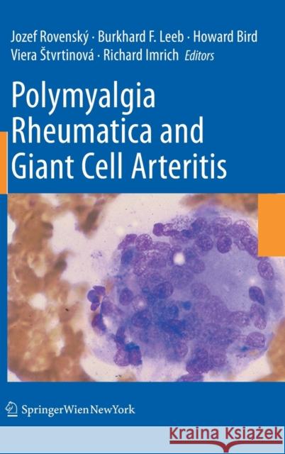 Polymyalgia Rheumatica and Giant Cell Arteritis Jozef Rovenska1/2 Burkhard F. Leeb Howard Bird 9783211993583 Springer