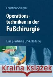 Operationstechniken in Der Fußchirurgie: Eine Praktische Op-Anleitung Sommer, Christian 9783211994221 Not Avail