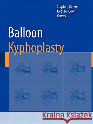 Balloon Kyphoplasty Stephan Becker Michael Ogon 9783211999080 Not Avail