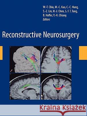 Reconstructive Neurosurgery Wen-Ta Chiu Ming-Chien Kao Ching-Chang Hung 9783211999271