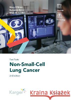 Fast Facts: Non-Small-Cell Lung Cancer O'Brien, Mary, Besse, Benjamin, Awad, Mark M. 9783318070101 S. Karger