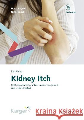 Fast Facts: Kidney Itch Rayner, Hugh, Sukul, Nidhi 9783318070743 S. Karger