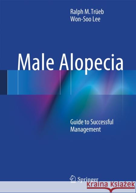 Male Alopecia: Guide to Successful Management Trüeb, Ralph M. 9783319032320