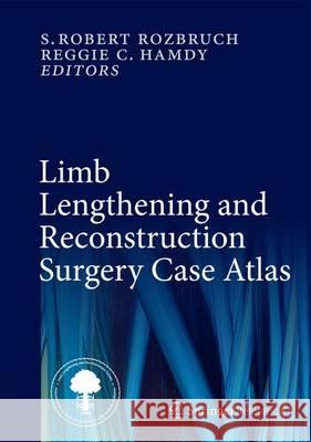 Limb Lengthening and Reconstruction Surgery Case Atlas Rozbruch, S. Robert 9783319036380 Springer