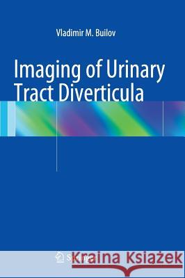 Imaging of Urinary Tract Diverticula Vladimir M. Builov 9783319053820 Springer