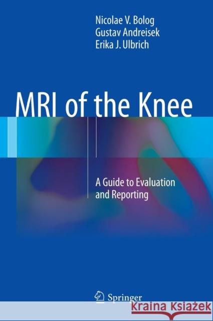 MRI of the Knee: A Guide to Evaluation and Reporting Bolog, Nicolae V. 9783319081649 Springer