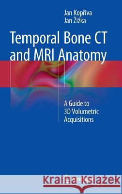 Temporal Bone CT and MRI Anatomy: A Guide to 3D Volumetric Acquisitions Kopřiva, Jan 9783319082417 Springer