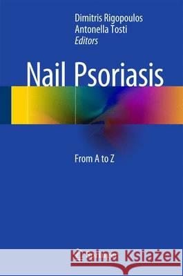 Nail Psoriasis: From A to Z Rigopoulos, Dimitris 9783319088099 Springer