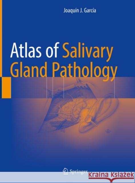 Atlas of Salivary Gland Pathology Joaquin J. Garcia 9783319090207