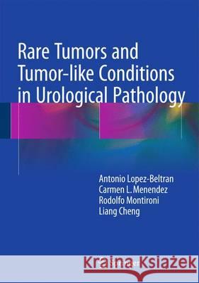 Rare Tumors and Tumor-Like Conditions in Urological Pathology Lopez-Beltran, Antonio 9783319102528 Springer