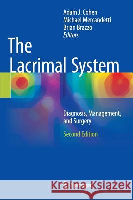 The Lacrimal System: Diagnosis, Management, and Surgery, Second Edition Cohen, Adam J. 9783319103310 Springer