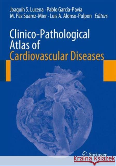 Clinico-Pathological Atlas of Cardiovascular Diseases Joaquin S. Lucena Pablo Garcia-Pavia M. Paz Suarez-Mier 9783319111452