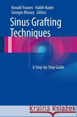 Sinus Grafting Techniques: A Step-By-Step Guide Younes, Ronald 9783319114477 Springer