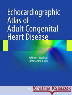 Echocardiographic Atlas of Adult Congenital Heart Disease Hakimeh Sadeghian Zahra Savand-Roomi 9783319129334 Springer