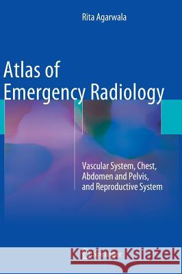 Atlas of Emergency Radiology: Vascular System, Chest, Abdomen and Pelvis, and Reproductive System Agarwala, Rita 9783319130415