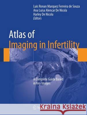 Atlas of Imaging in Infertility: A Complete Guide Based in Key Images De Souza, Luis Ronan Marquez Ferreira 9783319138923