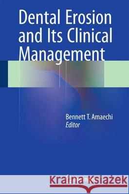Dental Erosion and Its Clinical Management Bennett Amaechi 9783319139920 Springer