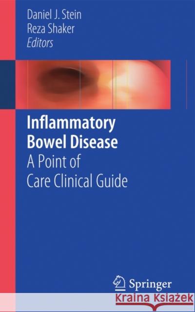 Inflammatory Bowel Disease: A Point of Care Clinical Guide Stein, Daniel J. 9783319140711 Springer