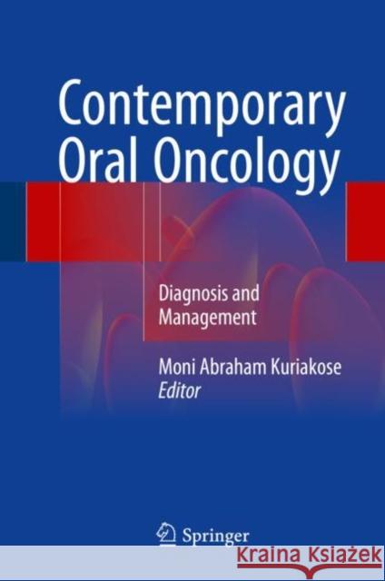 Contemporary Oral Oncology: Diagnosis and Management Kuriakose, Moni Abraham 9783319149165 Springer
