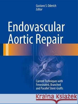 Endovascular Aortic Repair: Current Techniques with Fenestrated, Branched and Parallel Stent-Grafts Oderich, Gustavo S. 9783319151915 Springer