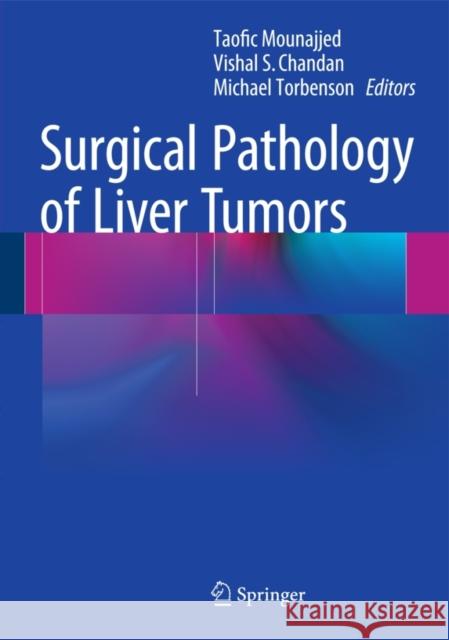 Surgical Pathology of Liver Tumors Taofic Mounajjed Vishal S. Chandan Michael Torbenson 9783319160887