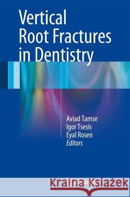 Vertical Root Fractures in Dentistry Aviad Tamse Aviad Tamse Igor Tsesis 9783319168463 Springer
