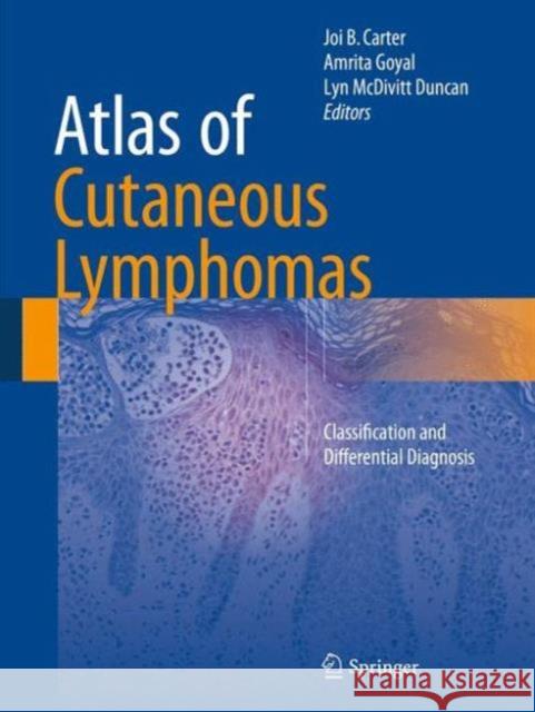 Atlas of Cutaneous Lymphomas: Classification and Differential Diagnosis Carter, Joi B. 9783319172163 Springer