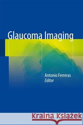 Glaucoma Imaging Antonio Ferreras 9783319189581