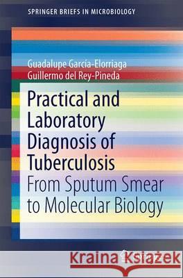 Practical and Laboratory Diagnosis of Tuberculosis: From Sputum Smear to Molecular Biology García-Elorriaga, Guadalupe 9783319204772