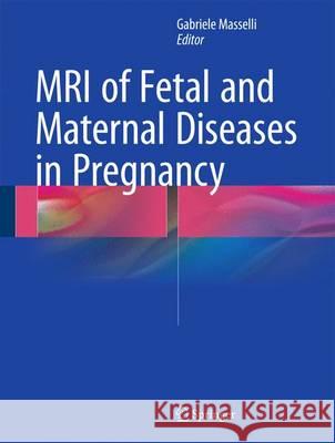 MRI of Fetal and Maternal Diseases in Pregnancy Gabriele Masselli 9783319214276 Springer