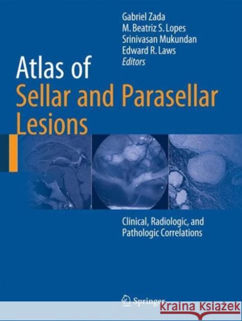 Atlas of Sellar and Parasellar Lesions: Clinical, Radiologic, and Pathologic Correlations Zada, Gabriel 9783319228549