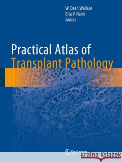 Practical Atlas of Transplant Pathology W. Dean Wallace Bita V. Naini 9783319230535 Springer