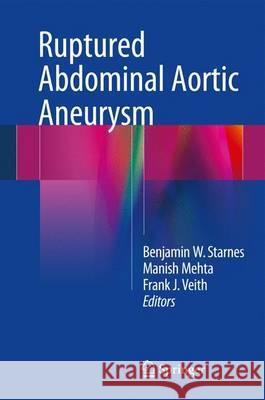 Ruptured Abdominal Aortic Aneurysm: The Definitive Manual Starnes, Benjamin W. 9783319238432 Springer