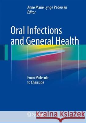Oral Infections and General Health: From Molecule to Chairside Lynge Pedersen, Anne Marie 9783319250892 Springer