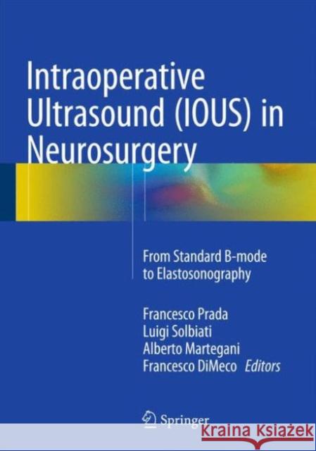 Intraoperative Ultrasound (Ious) in Neurosurgery: From Standard B-Mode to Elastosonography Prada, Francesco 9783319252667 Springer