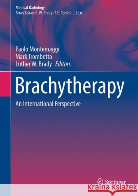 Brachytherapy: An International Perspective Montemaggi, Paolo 9783319267890 Springer