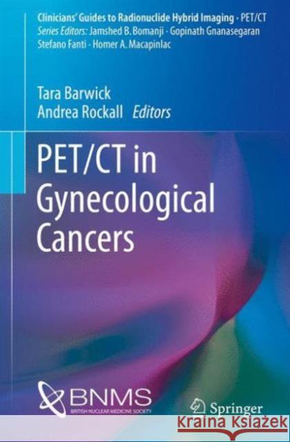 Pet/CT in Gynecological Cancers Barwick, Tara 9783319292472