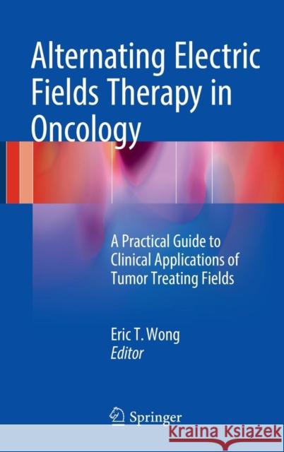 Alternating Electric Fields Therapy in Oncology: A Practical Guide to Clinical Applications of Tumor Treating Fields Wong, Eric T. 9783319305745