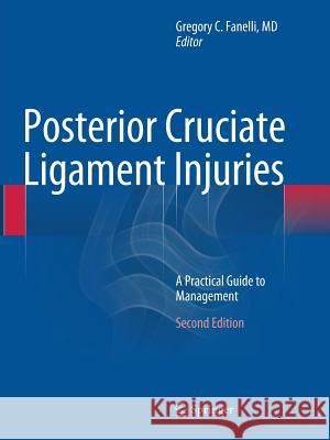Posterior Cruciate Ligament Injuries: A Practical Guide to Management Gregory C. Fanelli 9783319307749 Springer