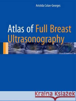 Atlas of Full Breast Ultrasonography Aristida Colan-Georges 9783319314174 Springer