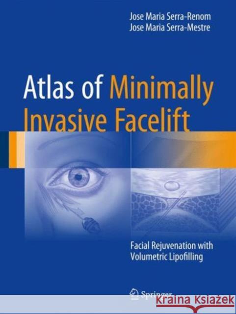 Atlas of Minimally Invasive Facelift: Facial Rejuvenation with Volumetric Lipofilling Serra-Renom, Jose Maria 9783319330167 Springer