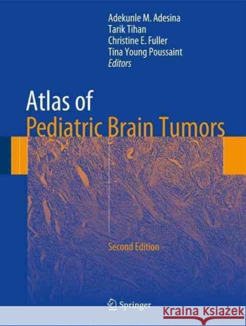 Atlas of Pediatric Brain Tumors Adekunle M. Adesina Tarik Tihan Christine E. Fuller 9783319334301 Springer