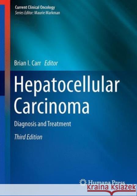 Hepatocellular Carcinoma: Diagnosis and Treatment Carr, Brian I. 9783319342122 Springer