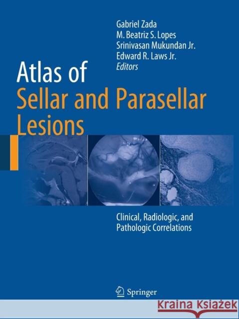 Atlas of Sellar and Parasellar Lesions: Clinical, Radiologic, and Pathologic Correlations Zada, Gabriel 9783319342719