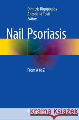 Nail Psoriasis: From A to Z Rigopoulos, Dimitris 9783319345734 Springer