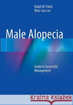 Male Alopecia: Guide to Successful Management Trüeb, Ralph M. 9783319349749