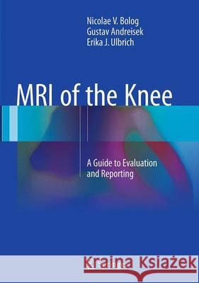 MRI of the Knee: A Guide to Evaluation and Reporting Bolog, Nicolae V. 9783319352534 Springer